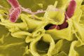 Color-enhanced scanning electron micrograph showing Salmonella Typhimurium (red) invading cultured human cells